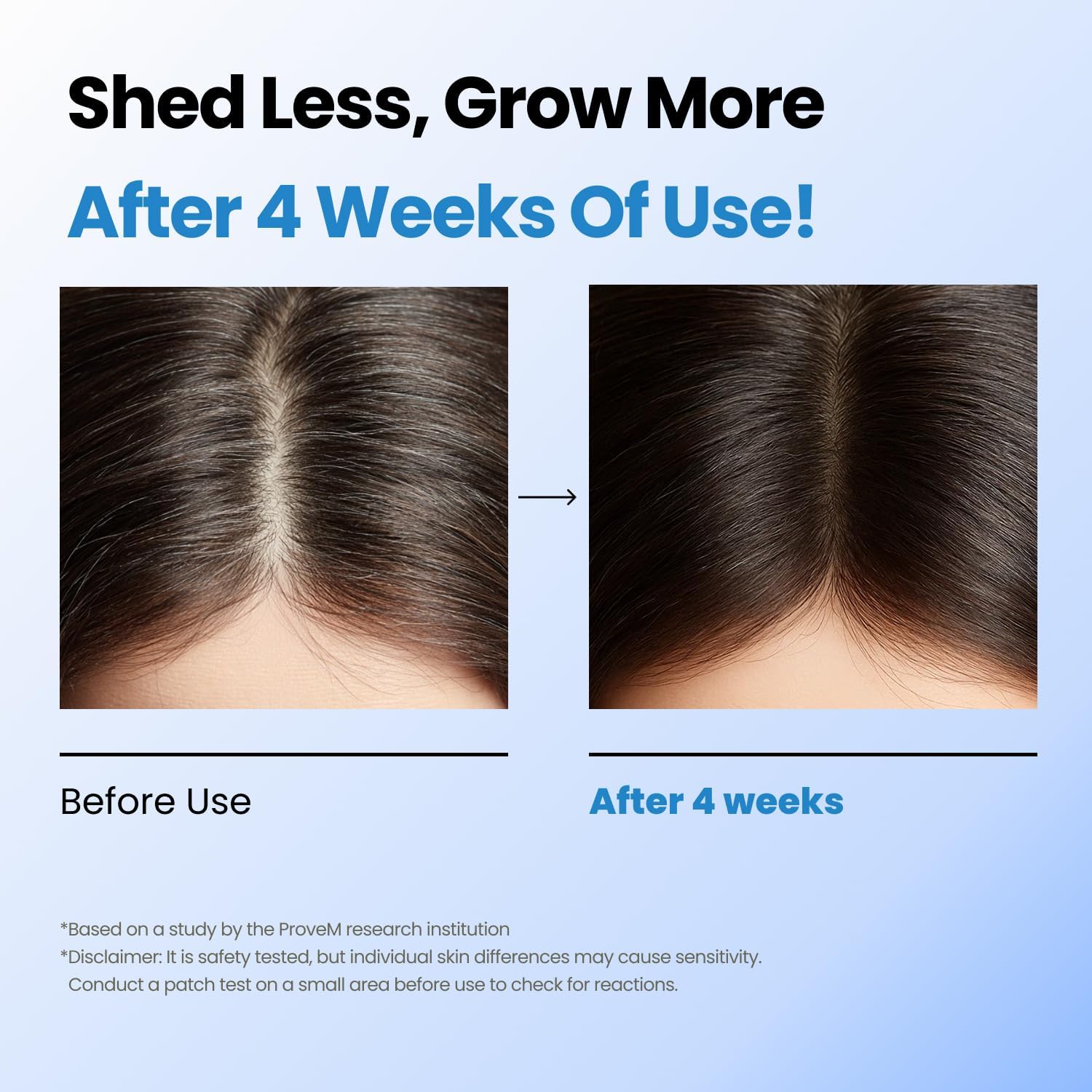 Scalpy Hair Growth Serum for Hair Loss & Thinning Scalp Massager Treatment Salicylic Acid, Menthol, Dexpanthenol Non-Greasy, Lightweight Exfoliate Dandruff - Image 5